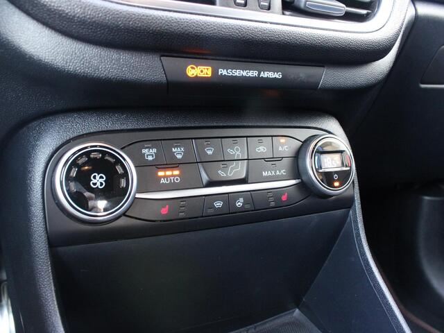 Ford FIESTA 1.0 EcoBoost ST-Line X